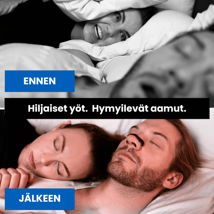 Flow - Magneettiset Nenänauhat